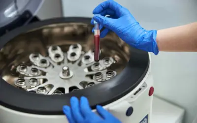 What is PRP Therapy? How Platelet Rich Plasma Injections Can Accelerate Healing